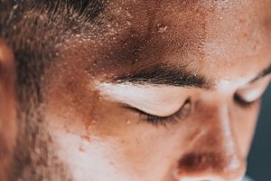 Excessive Sweating