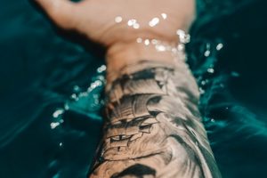 Laser Tattoo Removal