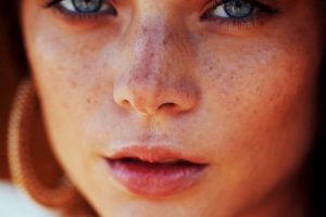 The Importance of Skin Cancer Screenings