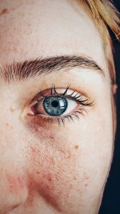 Common Reasons for Facial Redness