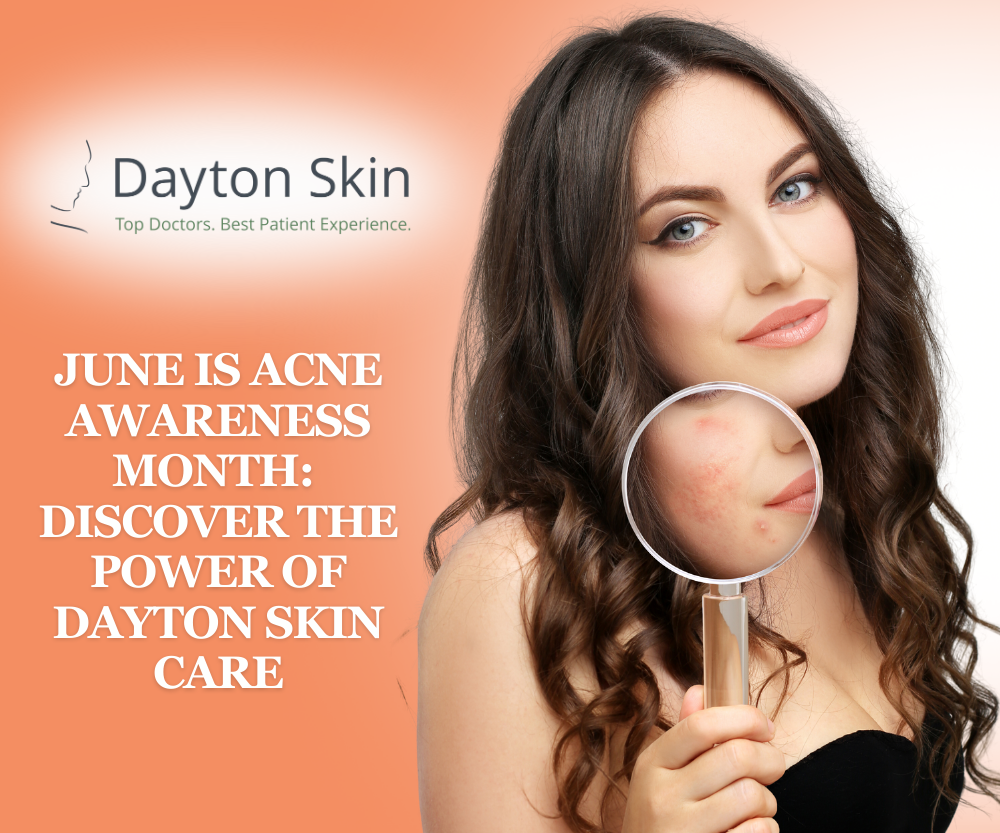 June is Acne Awareness Month discover the Power of Dayton Skin Care