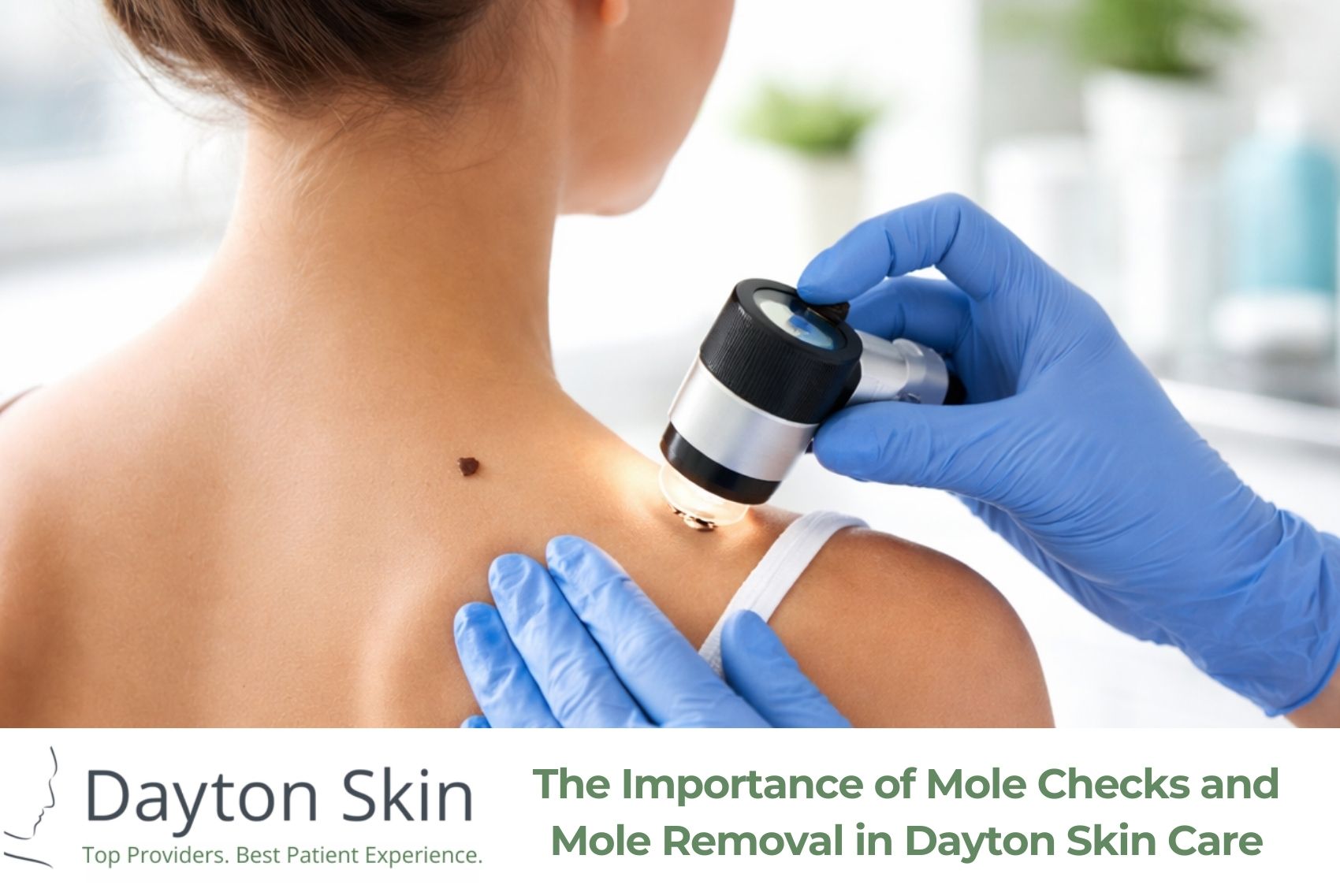 The Importance of Mole Checks and Mole Removal in Dayton Skin Care